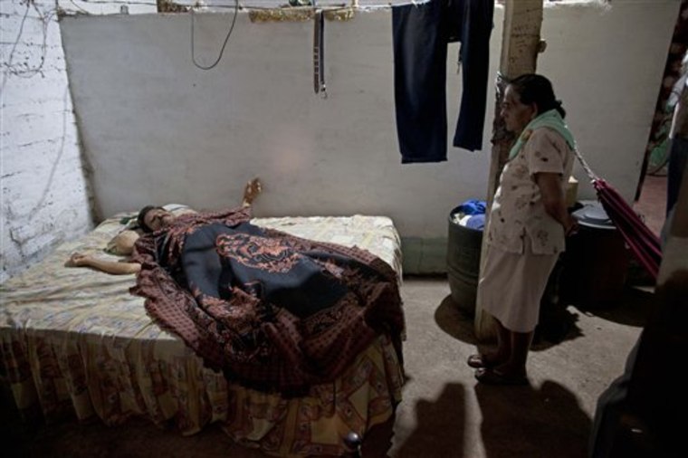 In this Wednesday, Jan. 4, 2012 photo, Ernestina Aleman, right, watches over her son Jesus Ignasio Flores, who suffers chronic kidney disease, as he rests in his bed in Chichigalpa, Nicaragua. Flores, 51, who died of chronic kidney disease on Jan. 19, worked as an irrigator and construction worker for 23 years at the San Antonio sugar plantation and mill. A mysterious epidemic is devastating the Pacific coast of Central America, killing more than 24,000 people in El Salvador and Nicaragua since 2000 and striking thousands of others with chronic kidney disease at rates unseen virtually anywhere else. Many of the victims were manual laborers or worked in the sugarcane fields that cover much of the coastal lowlands. (AP Photo/Esteban Felix)